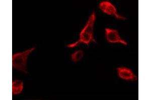 ABIN6274195 staining RAW264. (TNFRSF1B antibody  (C-Term))