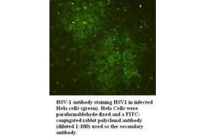 Image no. 1 for anti-Herpes Simplex Virus Type 1 (HSV1) antibody (ABIN791168) (Herpes Simplex Virus Type 1 (HSV1) antibody)