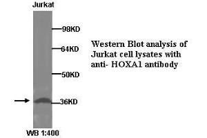 Image no. 1 for anti-Homeobox A1 (HOXA1) (Internal Region) antibody (ABIN790933)