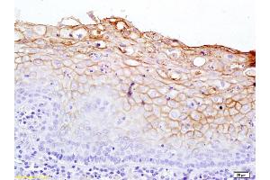 Formalin-fixed and paraffin embedded rat kidney tissue labeled with Rabbit Anti-Notch 2 Polyclonal Antibody, Unconjugated (ABIN680183) at 1:200 followed by conjugation to the secondary antibody and DAB staining. (NOTCH2 antibody  (AA 1501-1700))