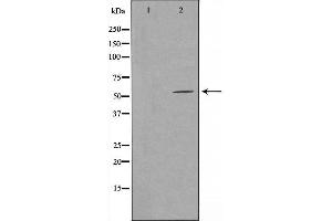 Western blot analysis of extracts from COLO cells, using GPR114 antibody.