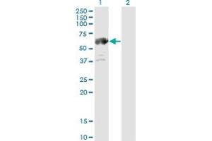 Western Blot analysis of ALDH4A1 expression in transfected 293T cell line by ALDH4A1 monoclonal antibody (M01), clone 1A12-A5. (ALDH4A1 antibody  (AA 1-563))