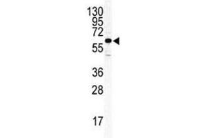 Western blot analysis of ILK2/ILK1 antibody and HeLa lysate. (ILK antibody  (AA 391-421))