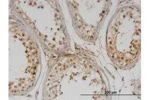 Image no. 1 for anti-DNA Methyltransferase 1-Associated Protein 1 (DMAP1) (AA 1-101) antibody (ABIN599578) (DMAP1 antibody  (AA 1-101))