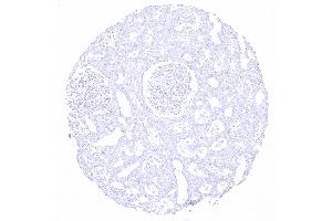 kidney cortex (Recombinant KRT20 antibody  (AA 196-323))