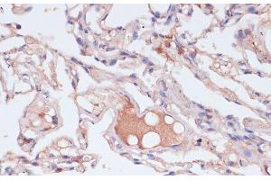 Immunohistochemistry of paraffin-embedded Human lung using IFNG Polyclonal Antibody at dilution of 1:100 (40x lens). (Interferon gamma antibody)