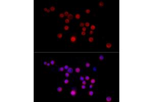 Immunofluorescence analysis of Neuro-2a cells using Nestin Rabbit pAb (ABIN6128335, ABIN6144536, ABIN6144537 and ABIN6215496) at dilution of 1:50 (40x lens). (Nestin antibody  (AA 1392-1621))