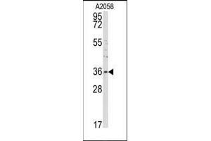 Western blot analysis of anti-ANXA2 Antibody (C-term) in A2058 cell line lysates (35ug/lane). (Annexin A2 antibody  (C-Term))