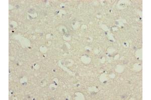Immunohistochemistry of paraffin-embedded human brain tissue using ABIN7174836 at dilution of 1:100