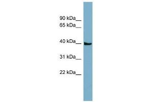 SLC35D3 antibody used at 1 ug/ml to detect target protein. (SLC35D3 antibody  (N-Term))