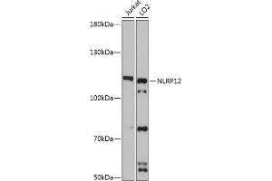 Western blot analysis of extracts of various cell lines, using NLRP12 antibody (ABIN7268938) at 1:3000 dilution. (NLRP12 antibody  (AA 862-1062))