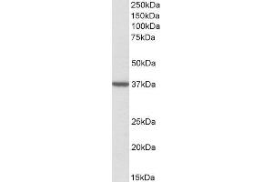 ABIN2560487 (2µg/ml) staining of Human Frontal Cortex lysate (35µg protein in RIPA buffer). (TOMM40 antibody  (Internal Region))