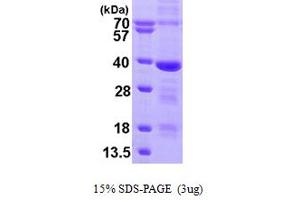 SDS-PAGE (SDS) image for Mediator Complex Subunit 4 (MED4) (AA 1-270) protein (His tag) (ABIN666993)