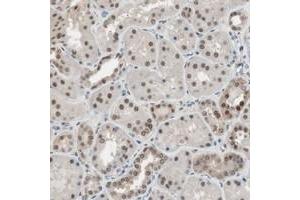 Immunohistochemical staining of human kidney with LONP2 polyclonal antibody  shows strong nuclear and weak cytoplasmic positivity in cells in tubules.