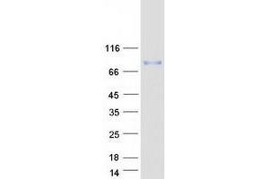 Western Blotting (WB) image for Transferrin Receptor (p90, CD71) (TFRC) protein (Myc-DYKDDDDK Tag) (ABIN2713769)