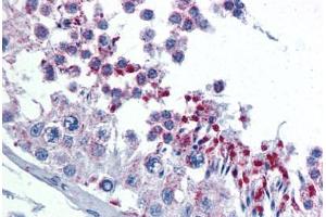 Human Testis: Formalin-Fixed, Paraffin-Embedded (FFPE) (GMP Synthase antibody  (AA 108-216))