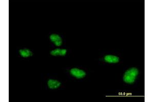 Immunofluorescence of purified MaxPab antibody to ZNF507 on HeLa cell.