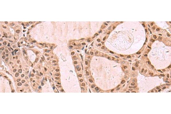 JHDM1D antibody