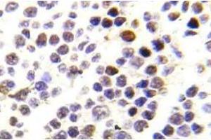 Immunohistochemistry (IHC) analyzes of p-Histone H3. (Histone H3.1 antibody  (pSer28))