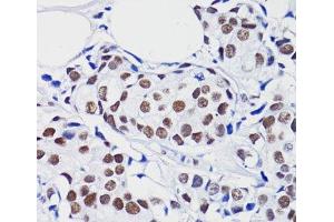 Immunohistochemistry (Paraffin-embedded Sections) (IHC (p)) image for anti-Histone H2B (acLys15) antibody (ABIN7258526)
