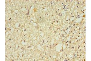 Immunohistochemistry of paraffin-embedded human brain tissue using ABIN7167621 at dilution of 1:100 (RGS7 antibody  (AA 1-487))