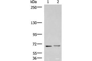 Western blot analysis of Mouse brain tissue and Human cerebrum tissue lysates using EXD2 Polyclonal Antibody at dilution of 1:700 (EXD2 antibody)