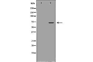 Western blot analysis of Jurkat whole cell lysates, using BIRC2 Antibody. (BIRC2 antibody  (C-Term))