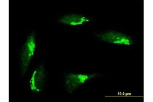 Immunofluorescence of purified MaxPab antibody to GORASP1 on HeLa cell. (GORASP1 antibody  (AA 1-440))