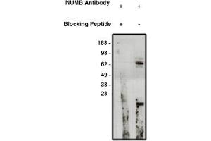 Image no. 1 for anti-Numb Homolog (NUMB) antibody (ABIN4620367) (NUMB antibody)