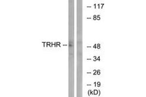 Western blot analysis of extracts from COS7 cells, using TRHR Antibody. (TRHR antibody  (AA 195-244))