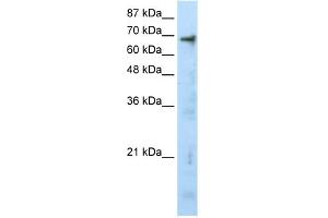 WB Suggested Anti-HTATIP Antibody Titration:  0. (KAT5 antibody  (N-Term))