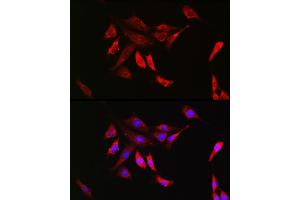 Immunofluorescence analysis of NIH/3T3 cells using SHP2 Rabbit mAb (ABIN7269704) at dilution of 1:100 (40x lens). (PTPN11 antibody)