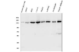 Western blot analysis of HAUSP/USP7 using anti-HAUSP/USP7 antibody (ABIN6719603). (USP7 antibody  (AA 258-483))
