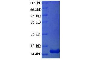 SDS-PAGE (SDS) image for Prolactin-Induced Protein (PIP) (AA 27-146), (full length) protein (His tag) (ABIN7479148)