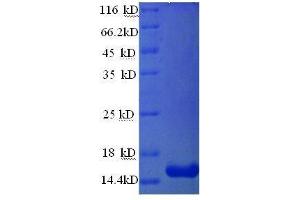 Prolactin-Induced Protein (PIP) (AA 27-146), (full length) protein (His tag)
