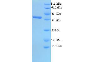 Outer Membrane Protein P5 (OMPA) (AA 27-349), (partial) protein (His tag)