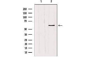 Western blot analysis of extracts from Hepg2, using MMP11 Antibody. (MMP11 antibody  (N-Term))