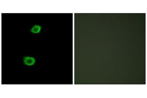 Immunofluorescence analysis of HepG2 cells, using LMTK2 antibody. (LMTK2 antibody  (Internal Region))