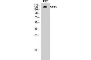 Western Blotting (WB) image for anti-Abelson Murine Leukemia Viral Oncogene Homolog 1/2 (ABL1/ABL2) (Lys5) antibody (ABIN3173634) (ABL1/2 antibody  (Lys5))