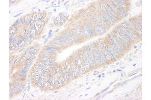 Immunohistochemistry (IHC) image for anti-KIAA1524 (KIAA1524) (AA 550-600) antibody (ABIN7454404)