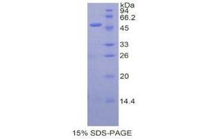 SDS-PAGE (SDS) image for Collagen, Type XVIII, alpha 1 (COL18A1) (AA 1296-1488) protein (His tag) (ABIN1878247)