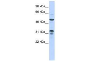 Image no. 1 for anti-Zinc Finger Protein 765 (ZNF765) (AA 108-157) antibody (ABIN6743557)