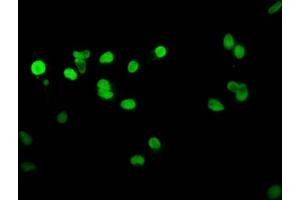 Immunofluorescent analysis of Hela cells using nme1HU at dilution of 1:100 and Alexa Fluor 488-congugated AffiniPure Goat Anti-Rabbit IgG(H+L)