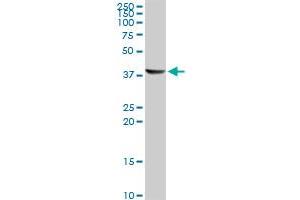 Western Blotting (WB) image for anti-Acetyl-CoA Acyltransferase 1 (ACAA1) (AA 217-316) antibody (ABIN599345) (ACAA1 antibody  (AA 217-316))