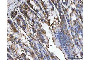 IHC analysis of CA1 using anti-CA1 antibody (ABIN3043766). (CA1 antibody  (AA 9-261))