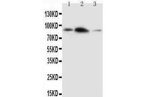 Anti-APLP2 antibody,  Western blotting Lane 1: Rat Brain Tissue Lysate Lane 2: Rat Heart Tissue Lysate Lane 3: SMMC Cell Lysate (APLP2 antibody  (C-Term))