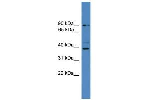 WB Suggested Anti-ZRANB1 Antibody Titration: 0. (ZRANB1 antibody  (C-Term))