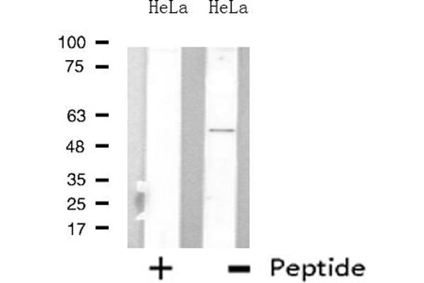 ARFGAP3 antibody  (C-Term)