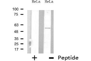 Western blot analysis of extracts from HeLa cells, using ARFGAP3 antibody. (ARFGAP3 antibody  (C-Term))