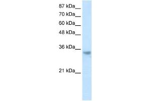 RNASEH2A antibody used at 1.
